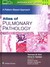Atlas of Pulmonary Pathology - Mahmood Butt Yasmeen, Tazelaar Henry D.